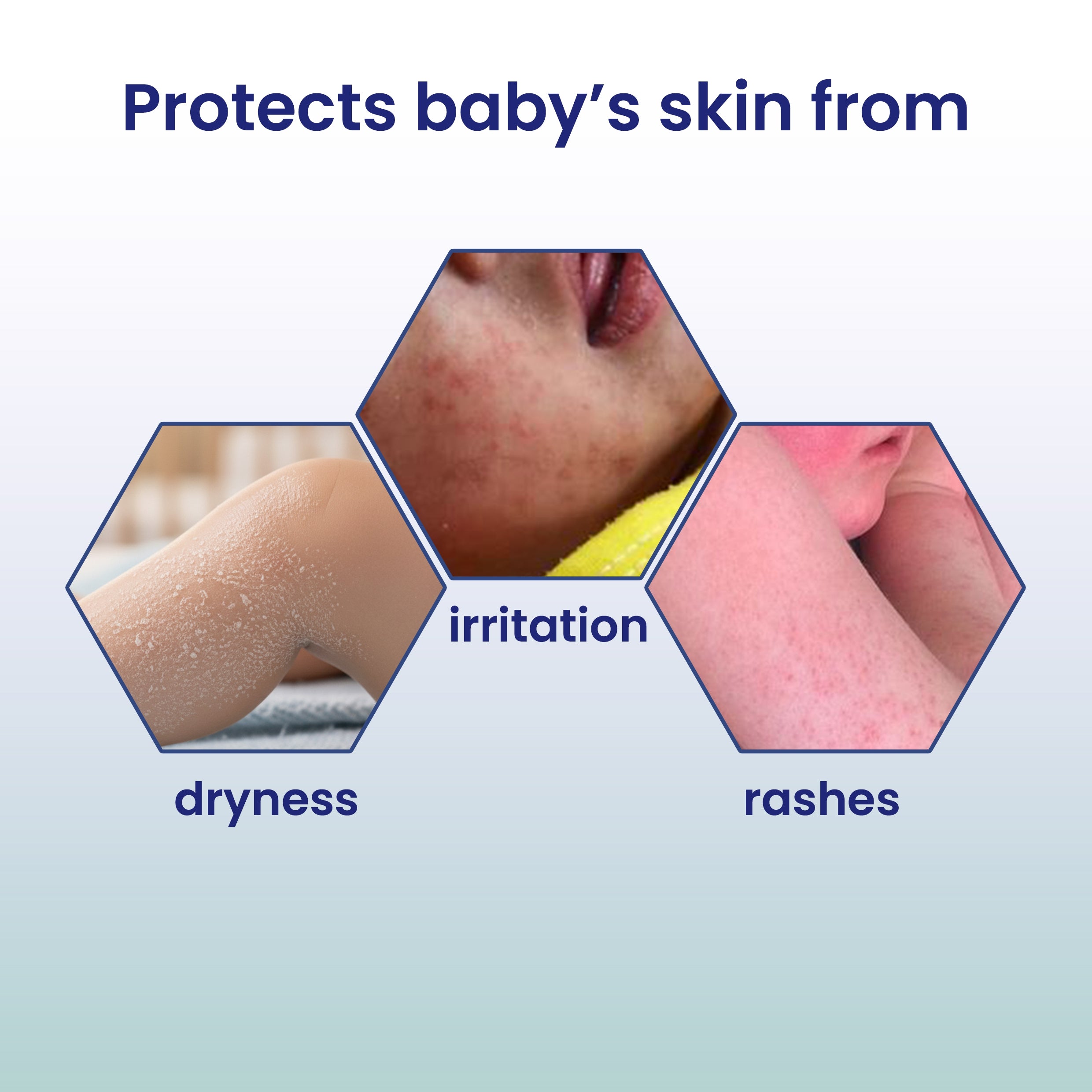 Baby Moisturizing Lotion for Soft and Hydrated Skin - Gentle Hydration for Sensitive Skin thumbnail 7